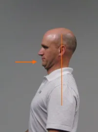 chin tuck