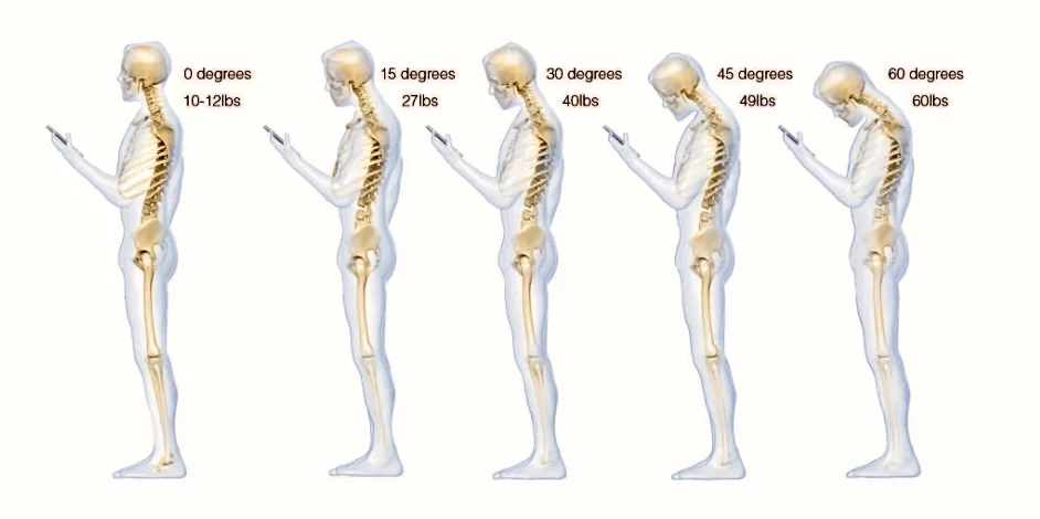 neck pain tech neck head weight