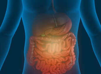 How Does Chiropractic Help Irritable Bowel Syndrome Sufferers?