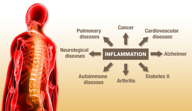 inflammatory connection